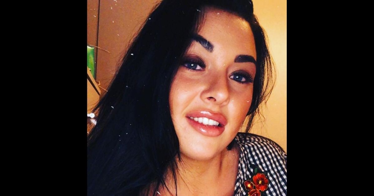 Woman Warns Others Not to Try Popular TikTok Egg Hack After Suffering Horrific Burns on Face and Neck