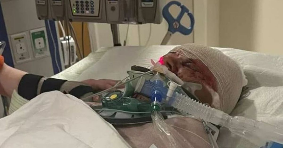 Mother of Three Clinging to Life After Nearly Being Mauled to Death by Three Dogs Near Her Home
