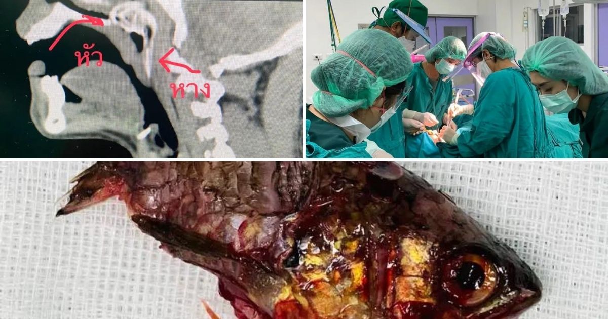 Freak Accident: Fish Jumps into Spearfisher's Mouth, Gets Stuck and Nearly Suffocates Him