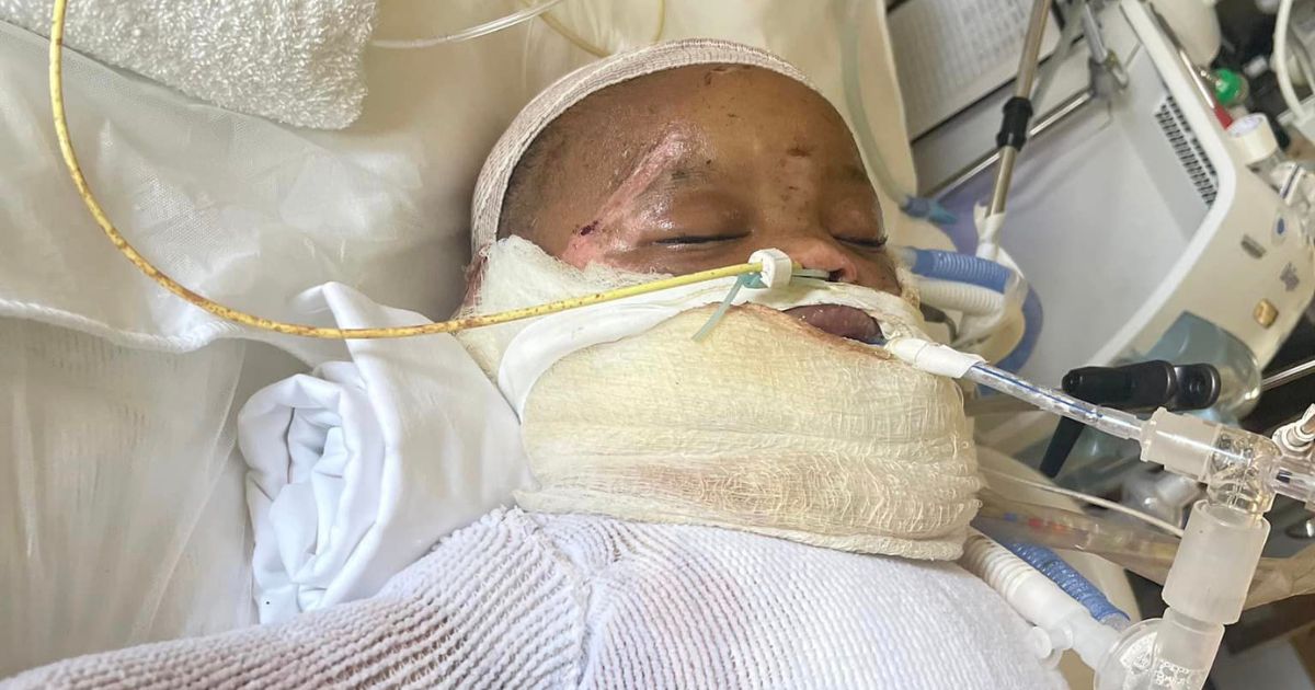 Amahd Black was in the hospital after suffering burns from an accident.